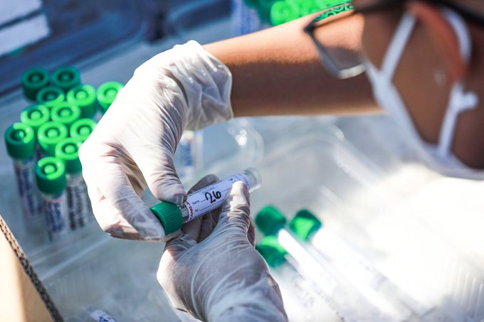Por noveno día consecutivo, Salud realizará pruebas PCR para detectar el COVID19 en San Salvador por-noveno-dia-consecutivo-salud-realizara-pruebas-pcr-para-detectar-el-covid19-en-san-salvador